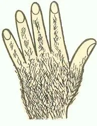 Illustration of a hairy human hand.