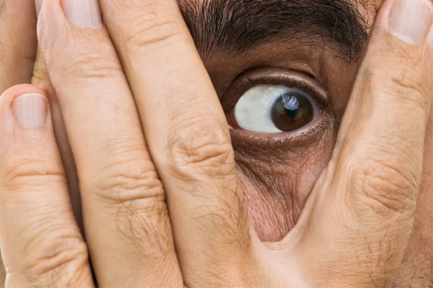 A person covering their face with their hand, revealing one eye.