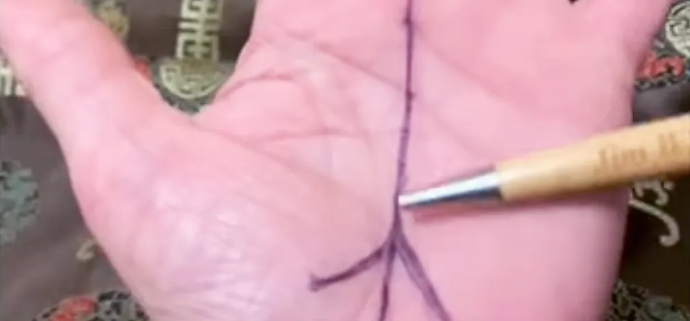 A line drawing on a palm with a pen pointing to it.