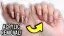 Acrylic nail removal process.