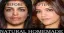 Before and after transformation showcasing the effects of a natural homemade beauty treatment.