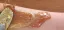 Amber sugar wax pulled with metal spatula across forearm, tugging fine hairs during at-home hair removal.